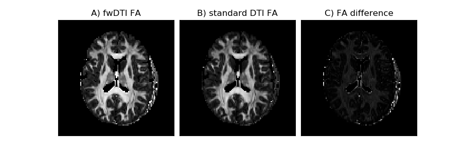 ../../_images/In_vivo_free_water_DTI_and_standard_DTI_corrected.png