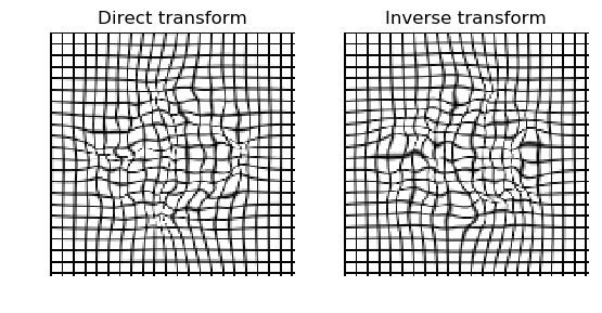 ../../_images/diffeomorphic_map_b0s.png