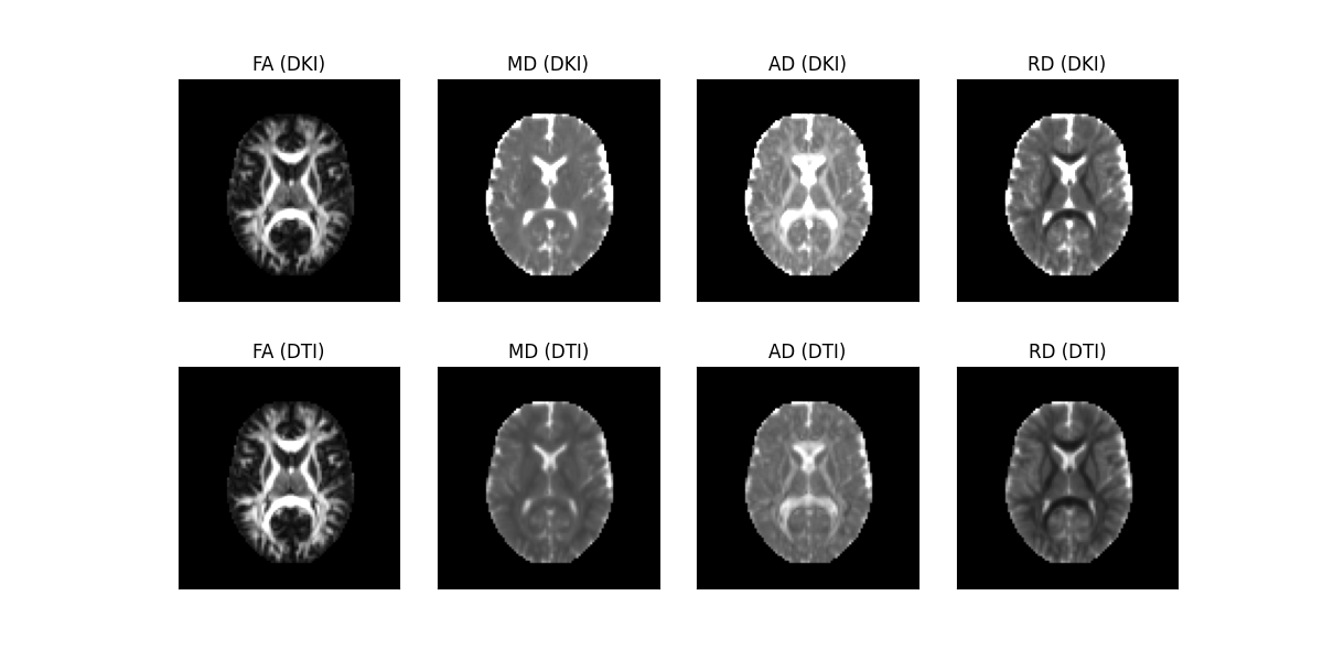 ../../_images/Diffusion_tensor_measures_from_DTI_and_DKI.png