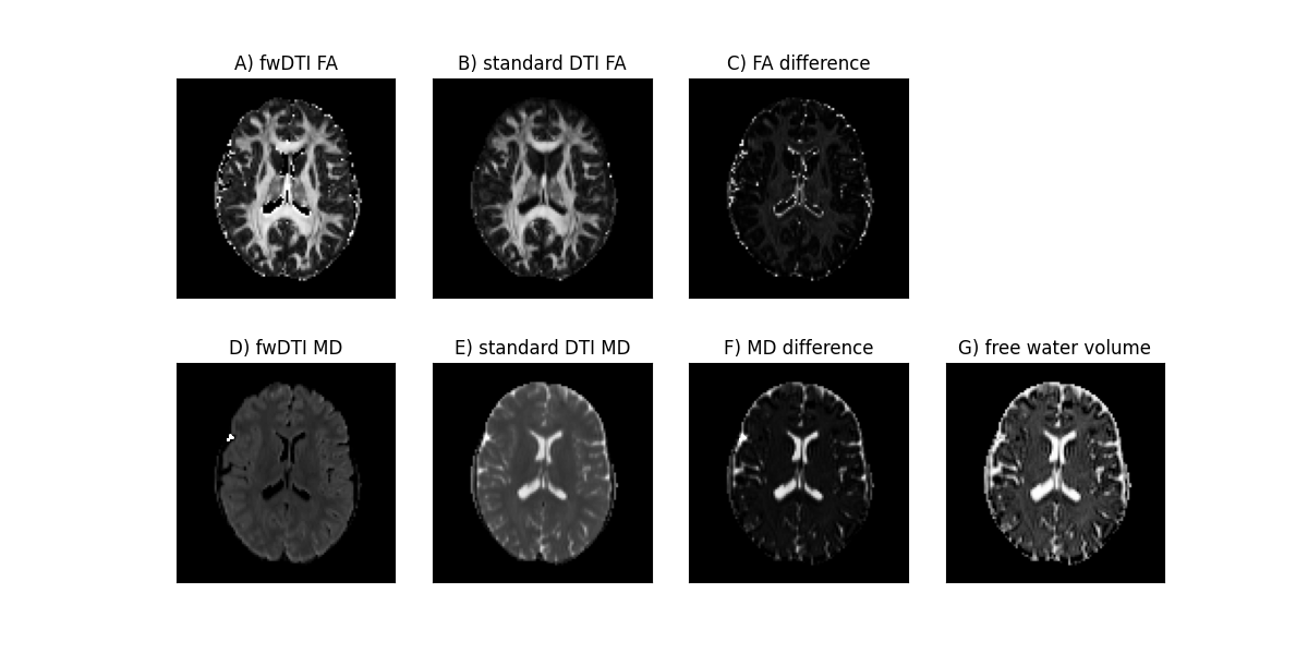 ../../_images/In_vivo_free_water_DTI_and_standard_DTI_measures.png