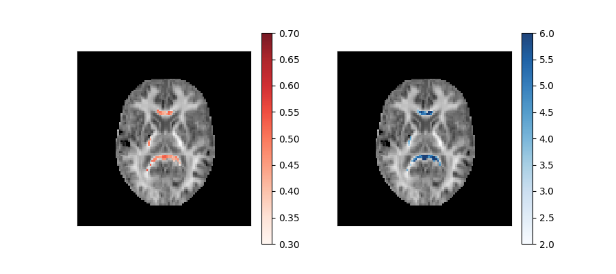 ../../_images/Kurtosis_Microstructural_measures.png