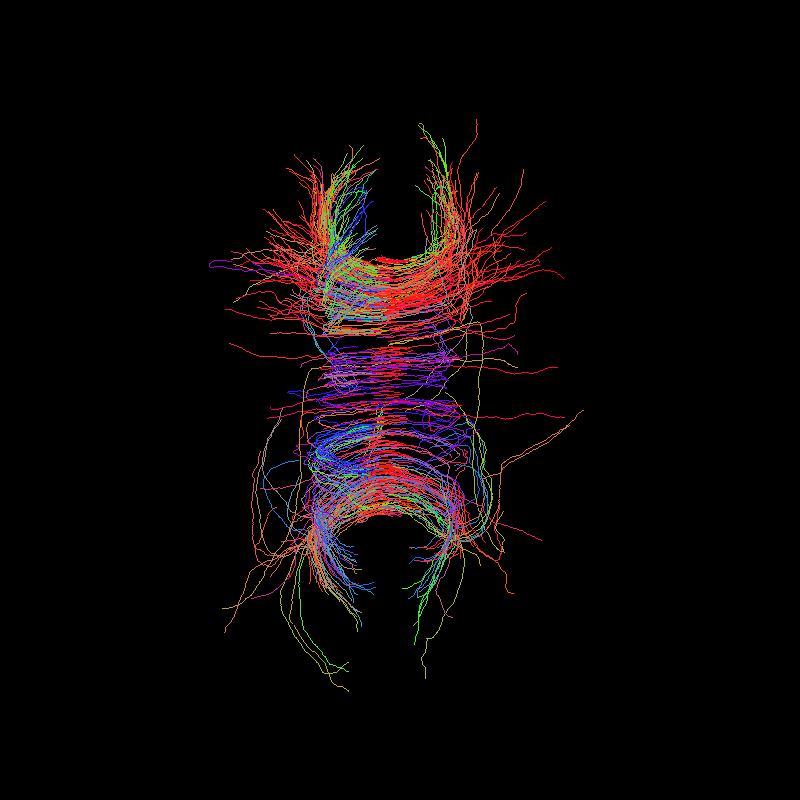 ../../_images/tractogram_probabilistic_cmc.png