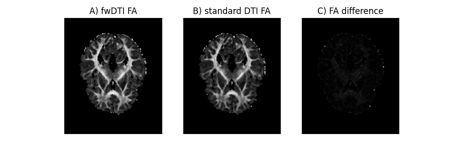 ../../_images/In_vivo_free_water_DTI_and_standard_DTI_corrected.png