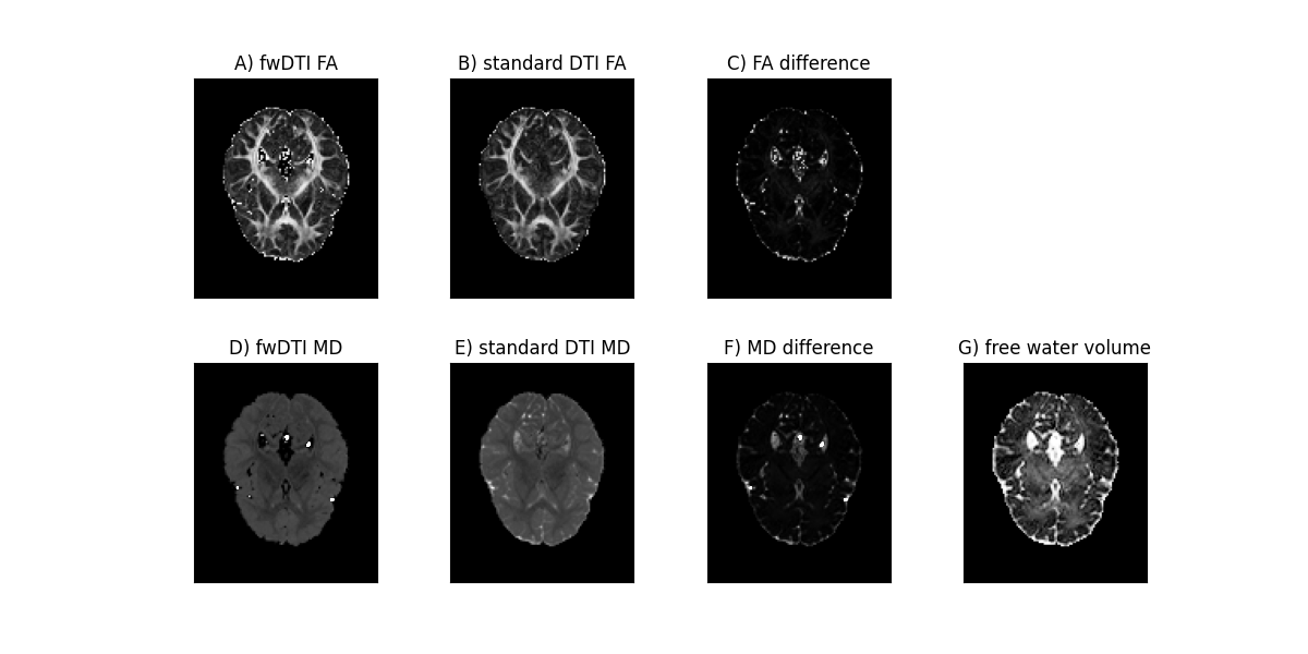 ../../_images/In_vivo_free_water_DTI_and_standard_DTI_measures.png