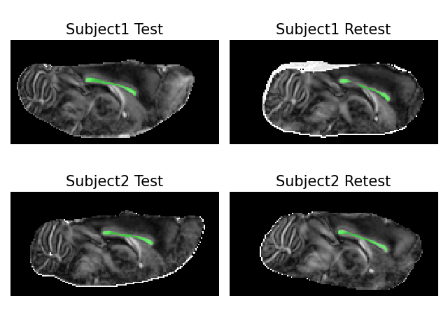 ../../_images/qt-dMRI_datasets_fa_with_ccmasks.png