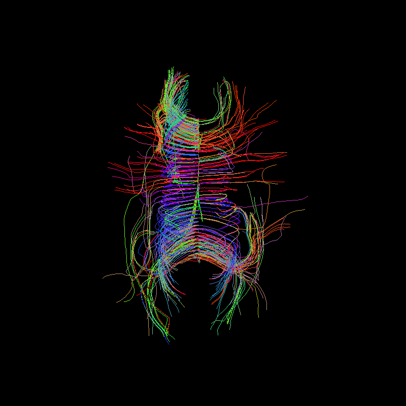 ../../_images/tractogram_deterministic_dg.png