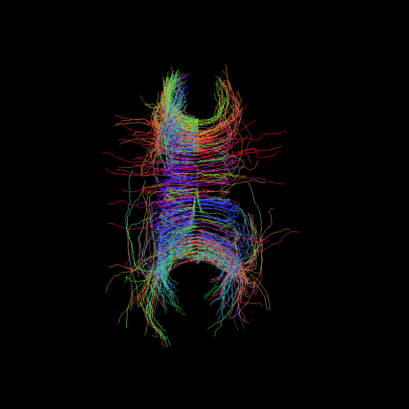 ../../_images/tractogram_probabilistic_dg_sh.png