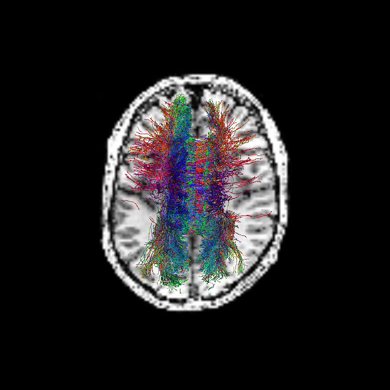 ../../_images/tractogram_probabilistic_rumba.png