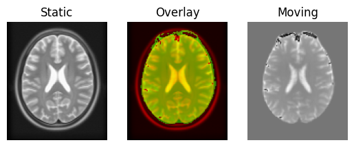 ../../_images/transformed_axial.png