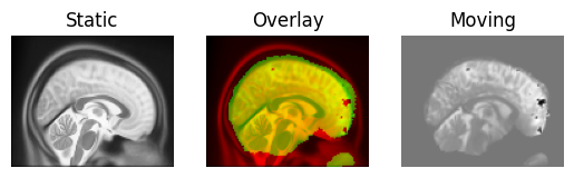 ../../_images/transformed_sagittal.png