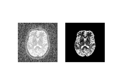 Brain segmentation with median_otsu