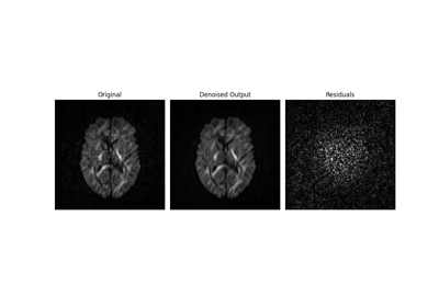 Denoise images using the Marcenko-Pastur PCA algorithm