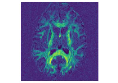 Reconstruct with Diffusion Spectrum Imaging