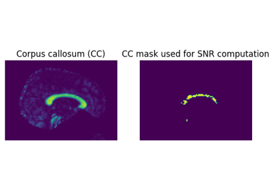 SNR estimation for Diffusion-Weighted Images