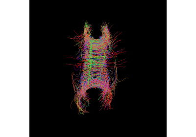 Parallel Transport Tractography