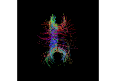 DIPY : Docs 1.7.0 - Fiber Tracking