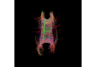 DIPY : Docs 1.7.0 - Fiber Tracking