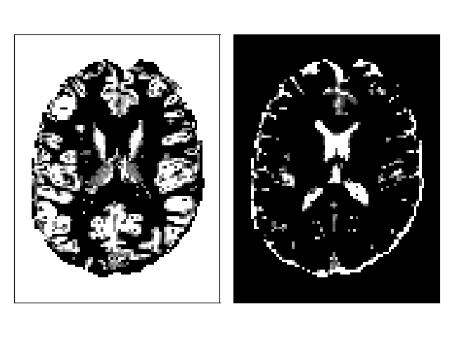 DIPY : Docs 1.7.0 - Using Various Stopping Criterion for Tractography